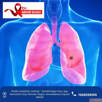 Best Lung Cancer Treatment in Ahmedabad - Dr. Mihir Shah