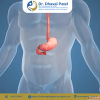 Trusted Gallbladder Cancer Surgery in Ahmedabad by Dr. Dhava...