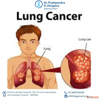 Personalized Lung Cancer Treatment in Ahmedabad with Modern Therapies