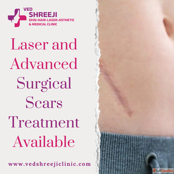 Laser and Advanced Surgical Scars Treatment Available