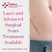 Laser and Advanced Surgical Scars Treatment Available
