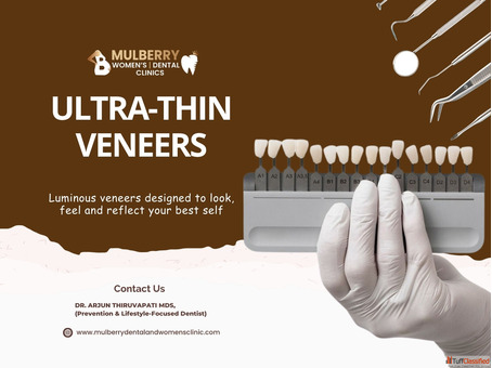 Veneers Solutions for Dental Smiles Hyderabad