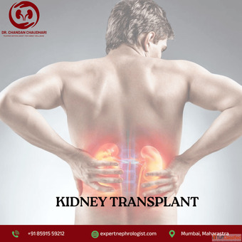 Kidney Transplant in Mumbai Expert Medical Support - Dr. Chandan Chaudhari
