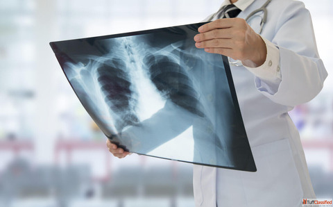 Inexpensive Chest X-Ray Radiology in India- Eskag Sanjeevani