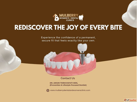 Premium Dental Implants Solutions Hyderabad Clinic