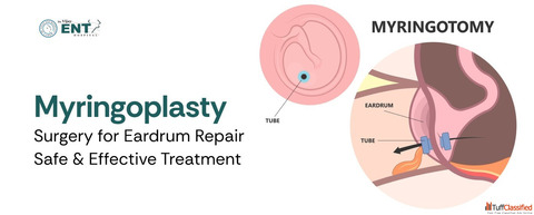 Myringoplasty Surgery for Eardrum Repair - Safe Effective Treatment