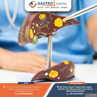 Best Gastroenterology Hospital in Ahmedabad with Modern Medi...