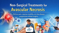 HipXpert - Non-Surgical Treatments for Hip Avascular Necrosi...