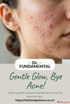 Gentle Glow Bye Acne