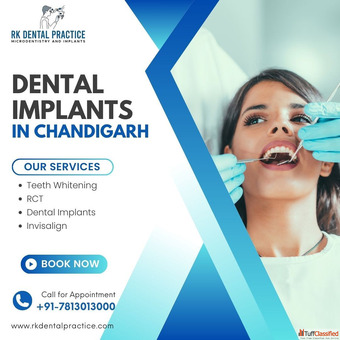 Dental Implants in Chandigarh - RK Dental Practice