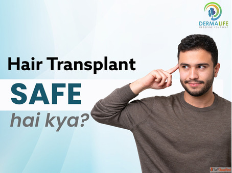 Hair Loss Solution with Hair Transplant in Noida NCR