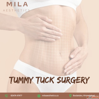 Tummy Tuck Surgery in Ahmedabad for a Flatter and Toned Abdomen