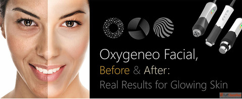 Affordable OxyGeneo Facial in Surrey Purely Pampered
