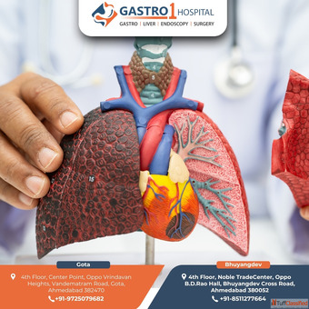 Best Liver Cancer Treatment in Ahmedabad with Advanced Medical Care