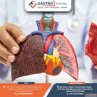 Best Liver Cancer Treatment in Ahmedabad with Advanced Medic...