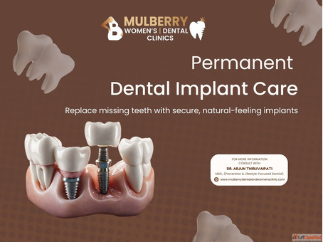 Trusted Clinic for Dental Implants in Hyderabad