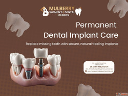 Trusted Clinic for Dental Implants in Hyderabad