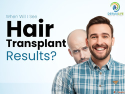Hair Transplant in Gurgaon - Advanced FUE Hair Restoration a...