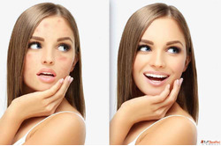 Acne vs Acne Scars Finding the Right Treatment for Clearer S...