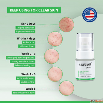 Niacinamide The Post-Gym "pH Balance" Stabilizer