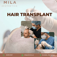 Best Hair Transplant in Ahmedabad FUE DHI Experts