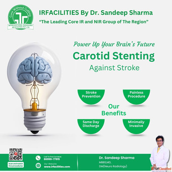 Why Choose Carotid Artery Stenting in India