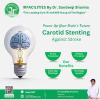 Why Choose Carotid Artery Stenting in India