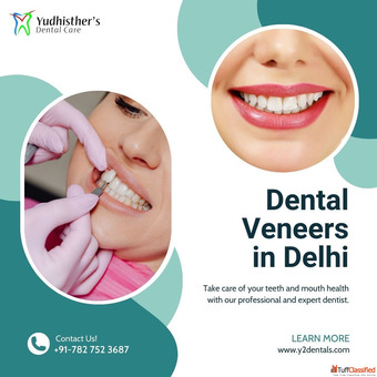 Veneers Treatment in Delhi