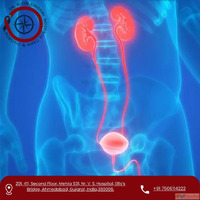 Best Urinary Bladder Cancer Treatment in Ahmedabad for Advan...