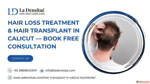 Hair Loss Treatment Hair Transplant in Calicut Book Free Consultation