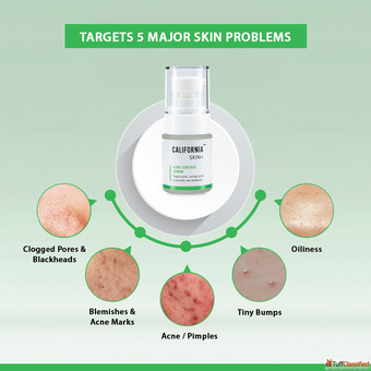 Niacinamide Building a Seasonal Barrier Shield