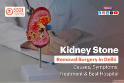 Kidney Stone Surgery in Delhi