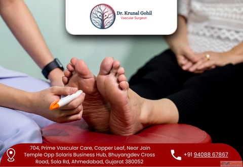 Gangrene Treatment in India by Dr.Krunal Gohil