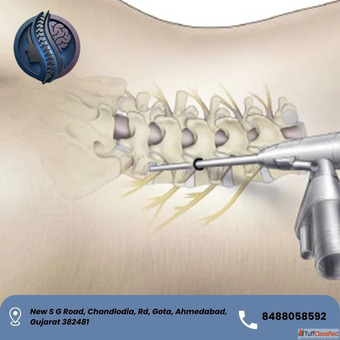 Best Endoscopic Spine Surgery in Ahmedabad - Dr. Deep Parmar