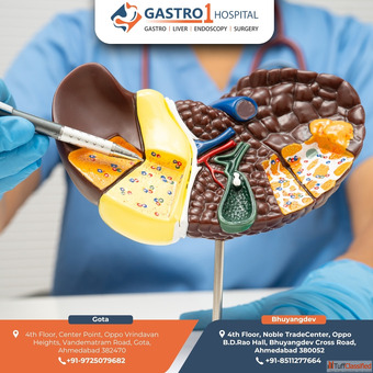 Gastro1 Hospital Provides Expert Liver Specialist in Ahmedabad