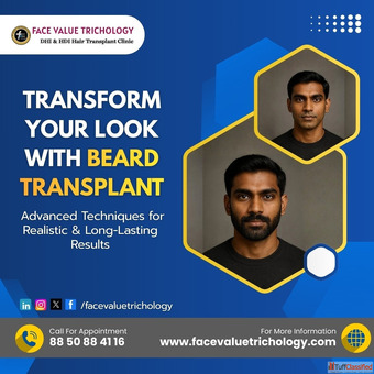 Beard Transplant in Chennai Natural Beard Hair Transplant Clinic