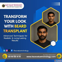 Beard Transplant in Chennai Natural Beard Hair Transplant Cl...