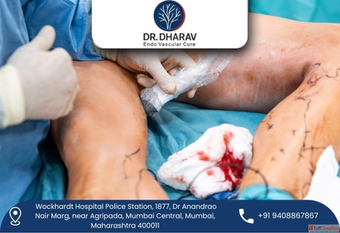 Dr.Dharav Kheradia - Endovascular Surgeon in India