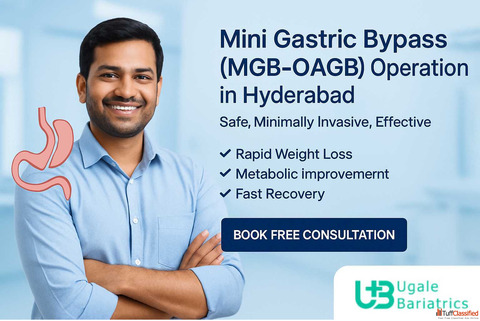 Mini Gastric Bypass MGB-OAGB Operation in Hyderabad Leading Weight Loss Clinic