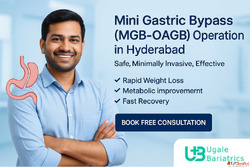 Mini Gastric Bypass MGB-OAGB Operation in Hyderabad Leading ...