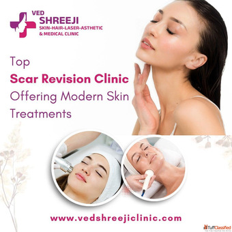 Top Scar Revision Clinic Offering Modern Skin Treatments