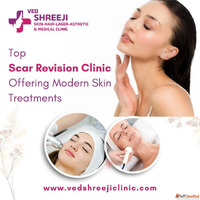 Top Scar Revision Clinic Offering Modern Skin Treatments