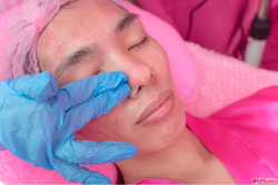 Effective Double Chin Treatment Skin Tightening Solutions in...