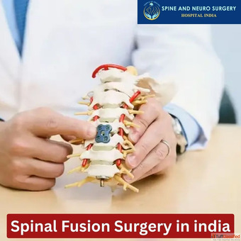 Top Spinal Fusion Doctors india