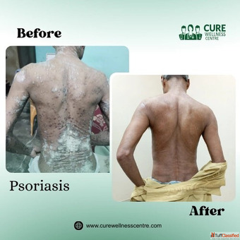 Cure Wellness Centre - Homeopathy Naturopathy In Meerut