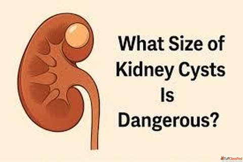 Understanding Kidney Cysts What Size Becomes Dangerous