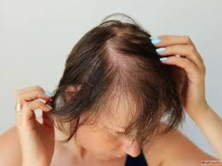 Natural Hair Fall Treatment in Homeopathy Without Side Effects