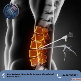 Top UBE Spine Surgery in Ahmedabad - Dr. Deep Parmar