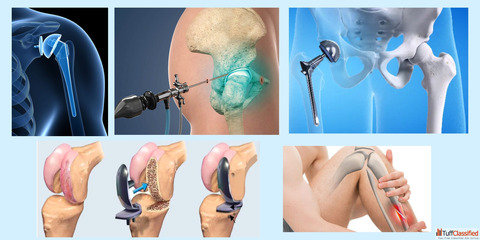 Best Ortho Pharmaceutical Company in India