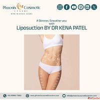 Shape Your Body with Liposuction Surgery in Ahmedabad l Phoe...